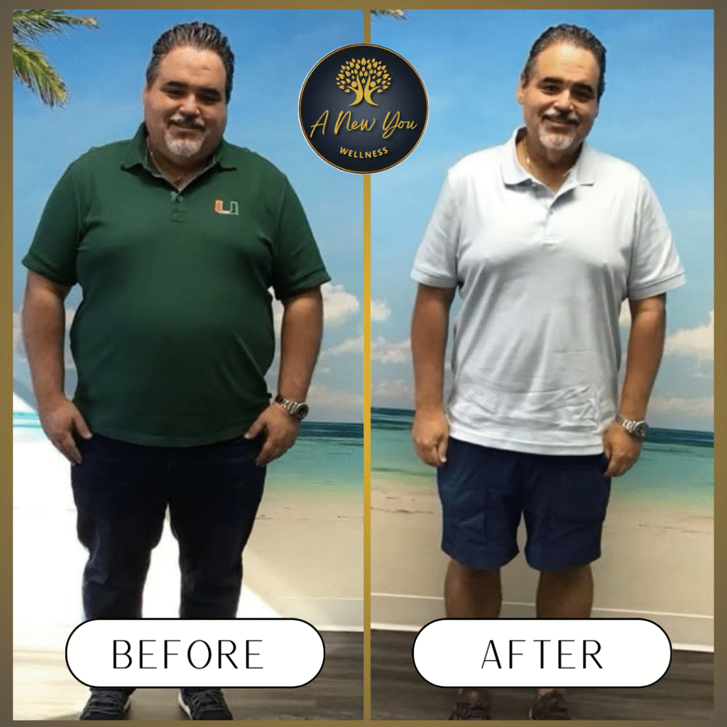 Weight loss Before and After A New You Wellness