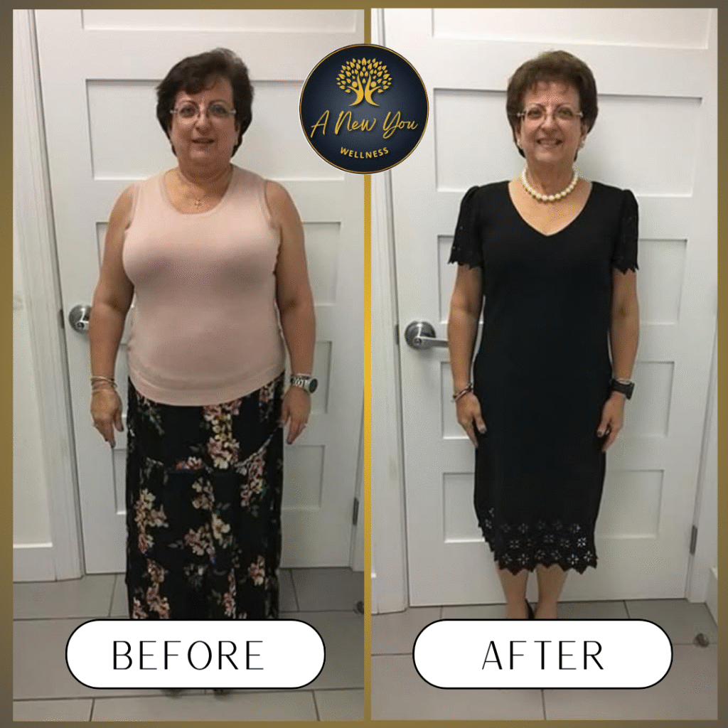 Weight loss Before and After A New You Wellness