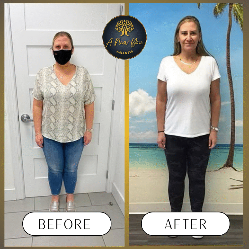 Weight loss Before and After A New You Wellness