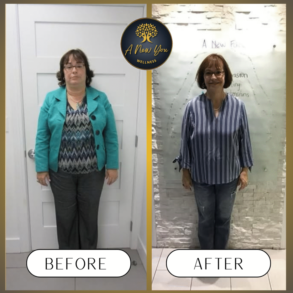 Weight loss Before and After A New You Wellness