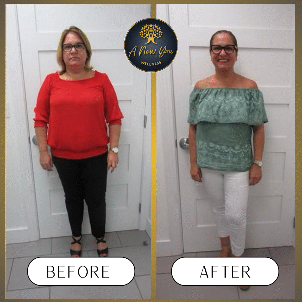 Weight loss Before and After A New You Wellness