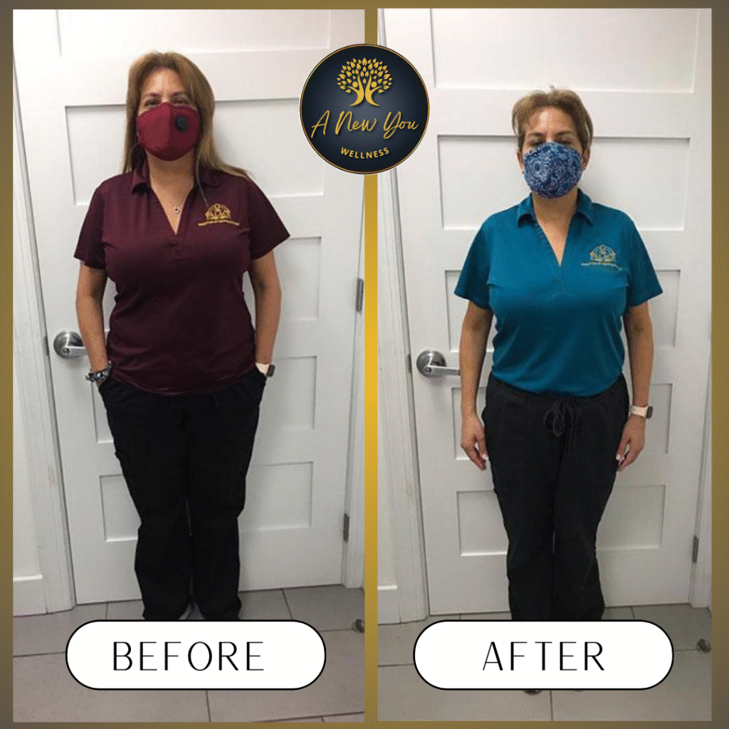 Weight loss Before and After A New You Wellness