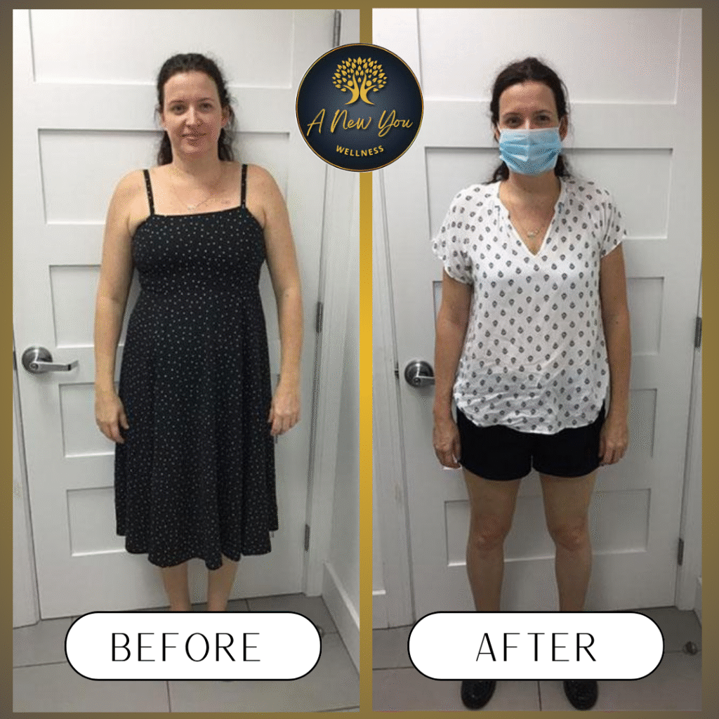 Weight loss Before and After A New You Wellness