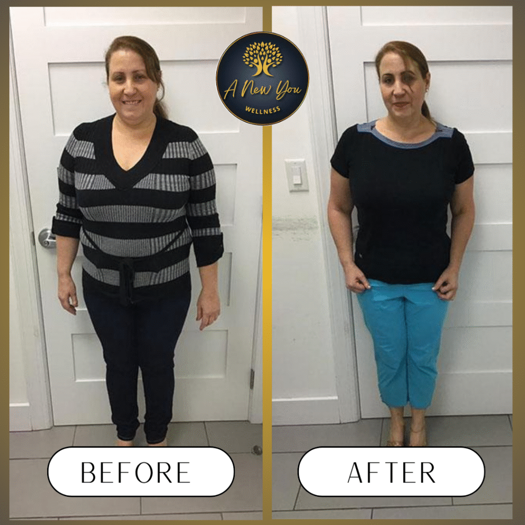 Weight loss Before and After A New You Wellness